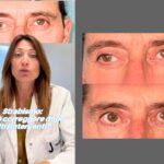 strabismo adulti Torino
